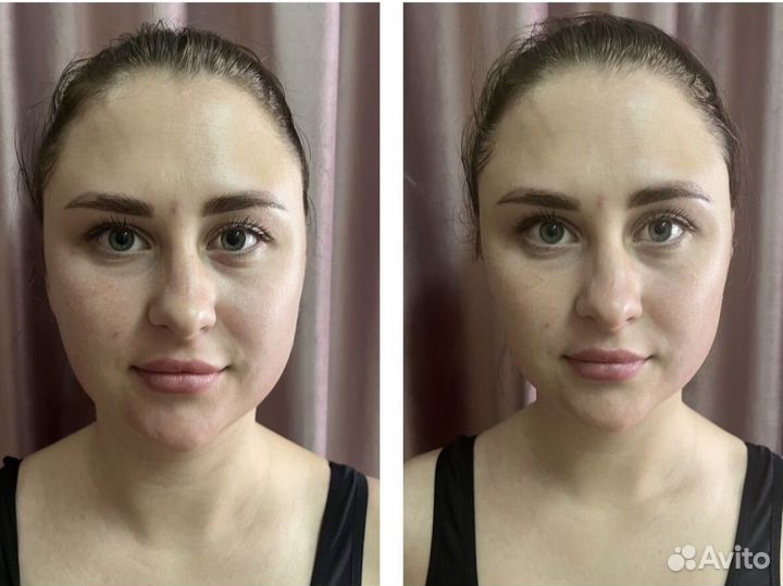 Аппаратное похудение, Массаж 