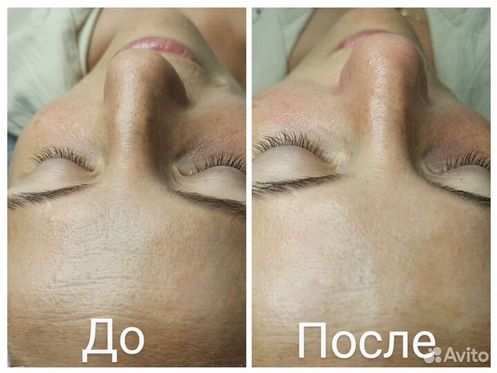 Услуги косметолога