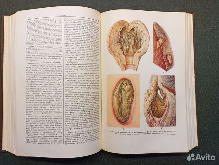 Большая медицинская энциклопедия. Том 29. 1963 
