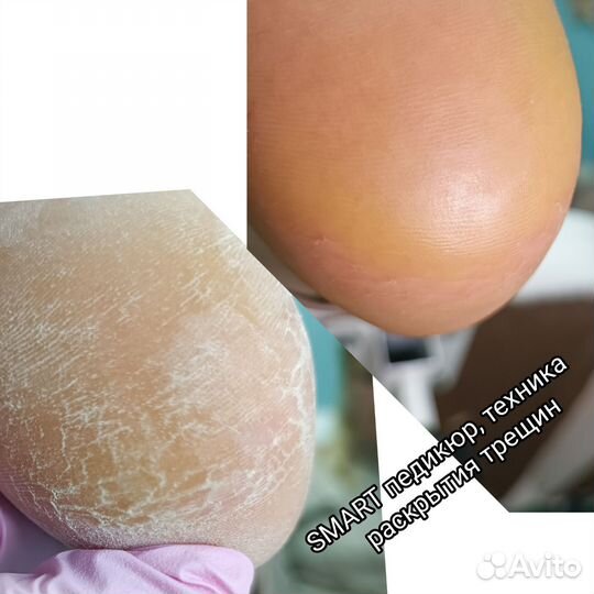 Маникюр. Педикюр. Наращивание ногтей