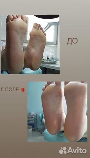 Педикюр/подолог