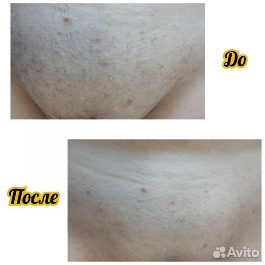 Модель на шугаринг