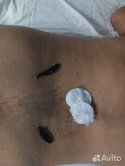 Гирудотерапевт