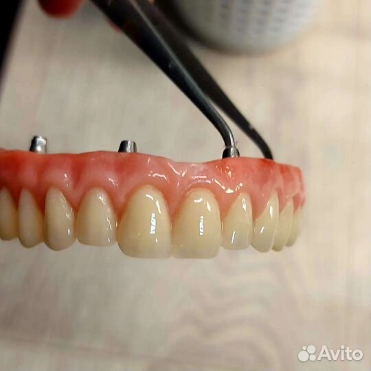 Починки зубных протезов