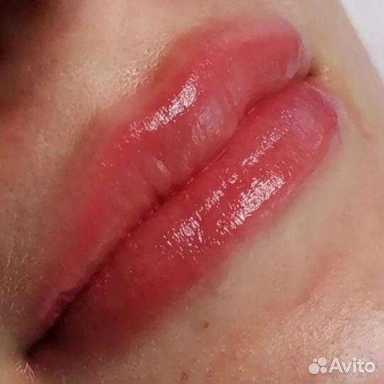 Перманентный макияж Удаление татуажа