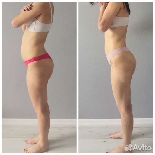 Массаж, Тейпирование, Юмейхо