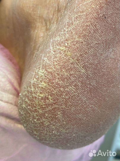 Услуги подолога