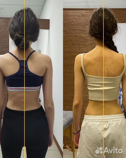 Реабилитация, Массаж, лфк