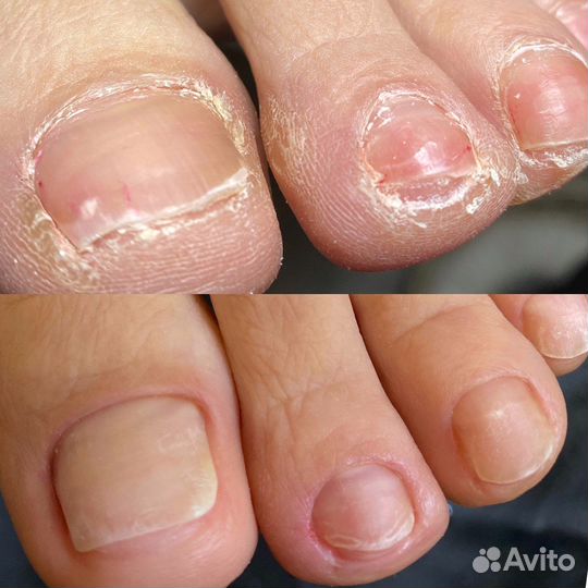 Маникюр, педикюр