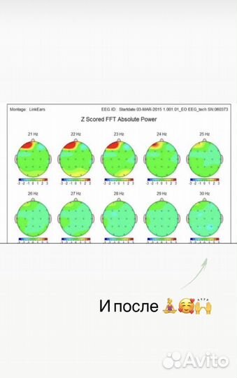Массаж access bars (Аксесс Барс)