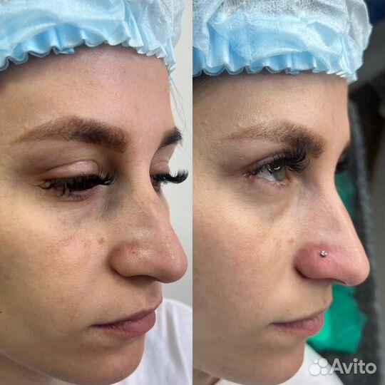 Пирсинг любой