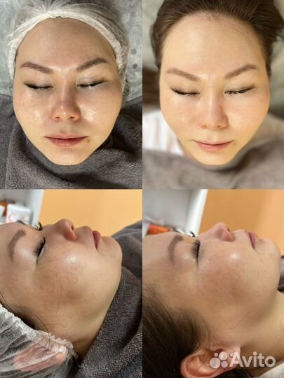 Услуги косметолога