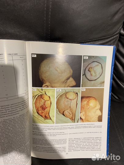 Книги по хирургии Миланов Шилов
