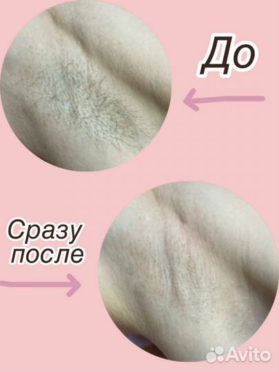 Женский шугаринг