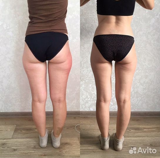 Массаж лица, антицеллюлитный, классический, лимфо