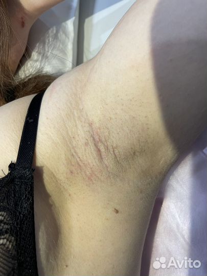 Шугаринг/Воск