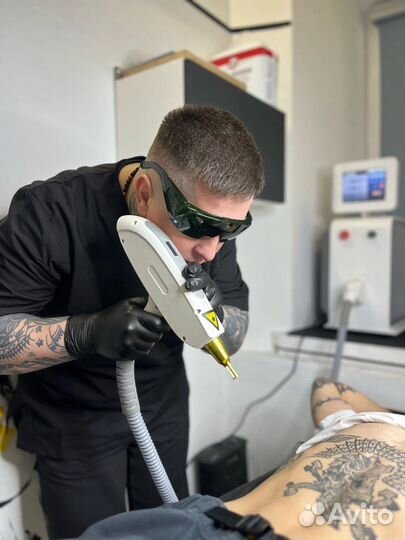 Лазерное удаление тату