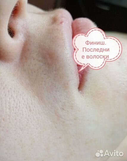 Электроэпиляция Apilus, Обучение электроэпиляции