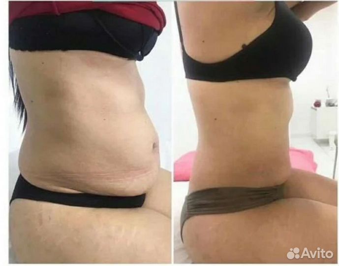 Коррекция фигуры