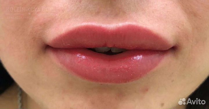 Перманентный макияж и удаление татуажа ремувером