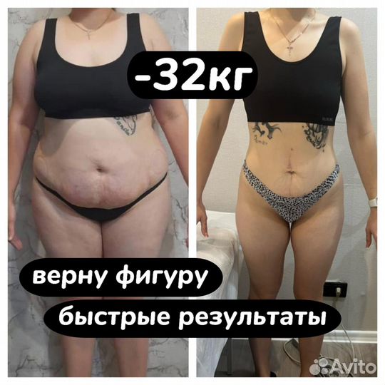 Массаж Криолиполиз LPG массаж Чистка лица Подтяжка