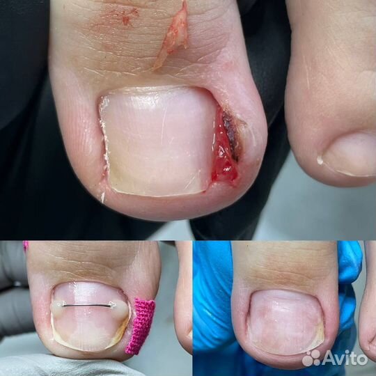 Услуги подолога