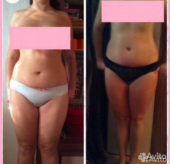 Антицеллюлитный массаж