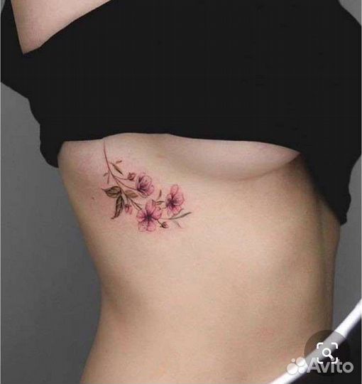 Удаление татуировок