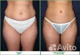 Коррекция фигуры