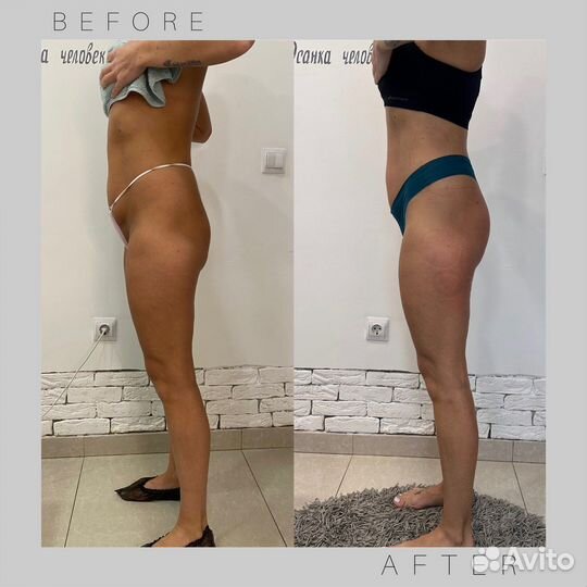 Коррекция фигуры