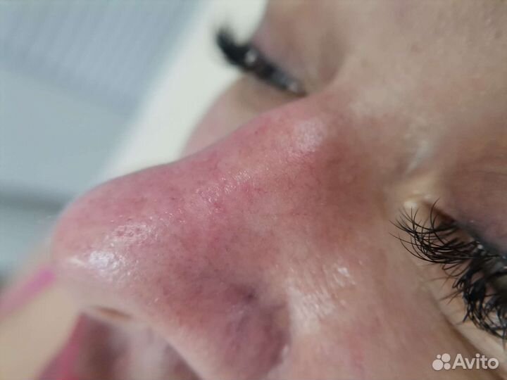 Уз чистка лица + маска