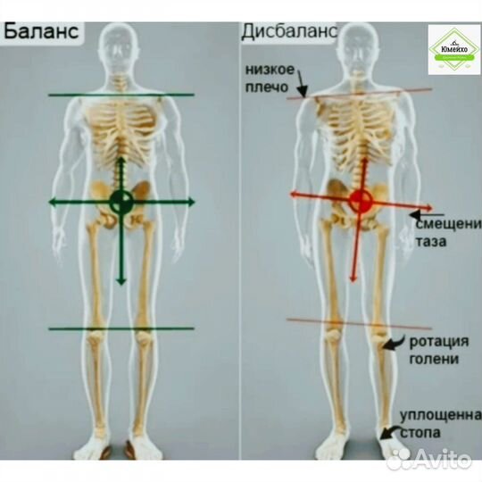 Костоправ.Массаж. Юмейхо.Пирм.Правка живота