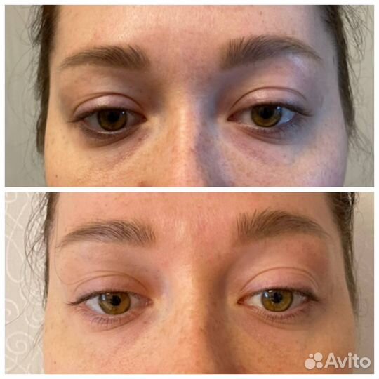 Холодная плазма