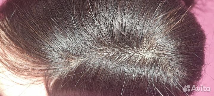 Система замещения волос, парики, накладки