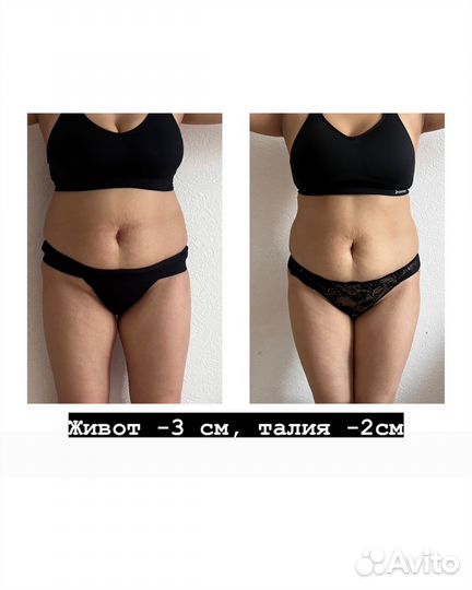 Экспресс похудение до -5см за сеанс/кавитация