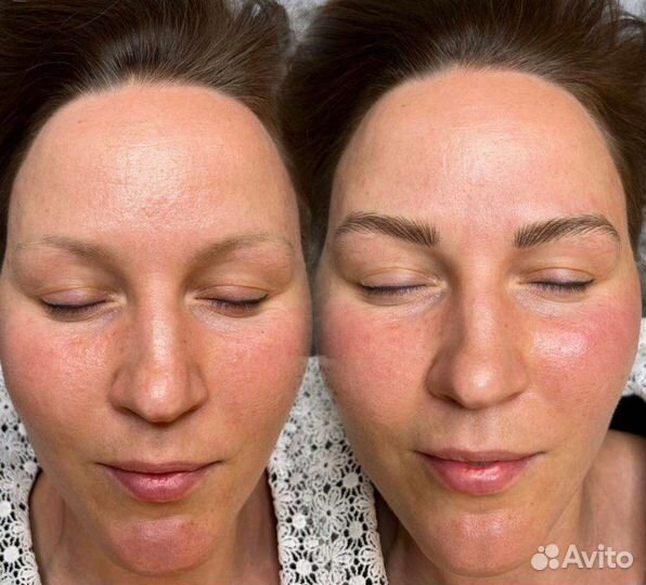 Аппаратные волосковый татуаж