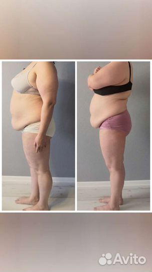 Массаж, Тейпирование, Юмейхо