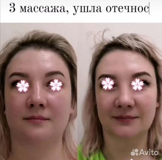 Массаж, чистки, пилинги, аппаратная косметология