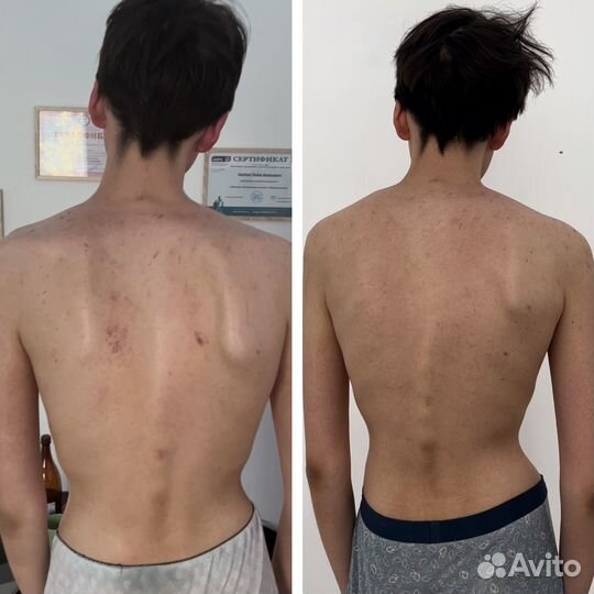 Манульный массаж, костоправ, без боли