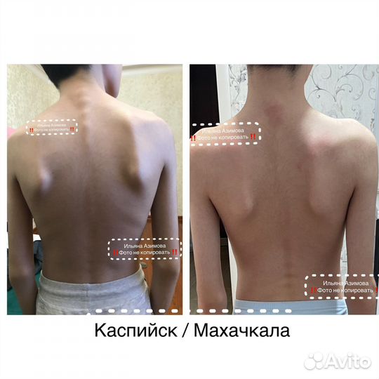 Детский Массаж на дому