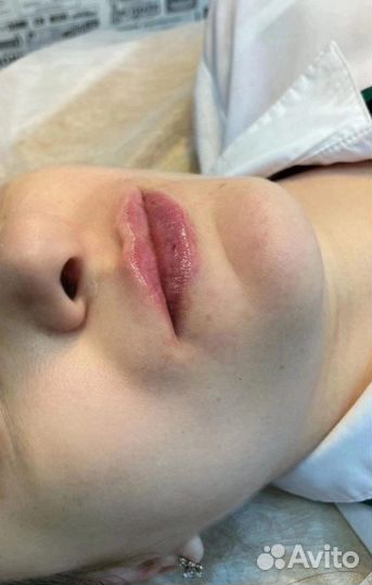 Обучение косметологии без медицинского обр-Ия