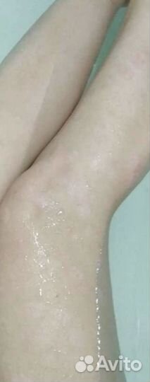 Мазь от псориаза