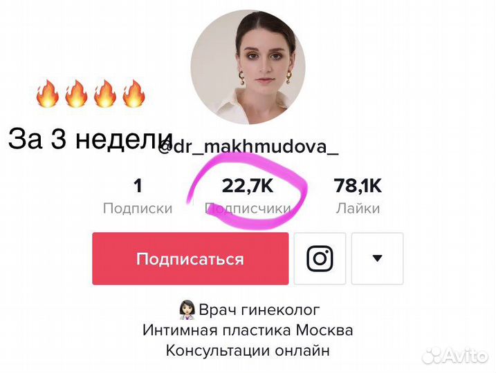 Сценарии reels съёмка видео