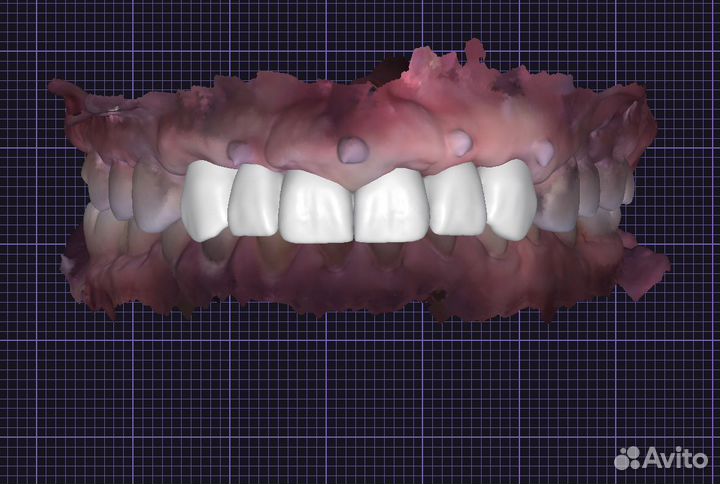 Зубной техник. Моделировка ExoCad. Готовая работа