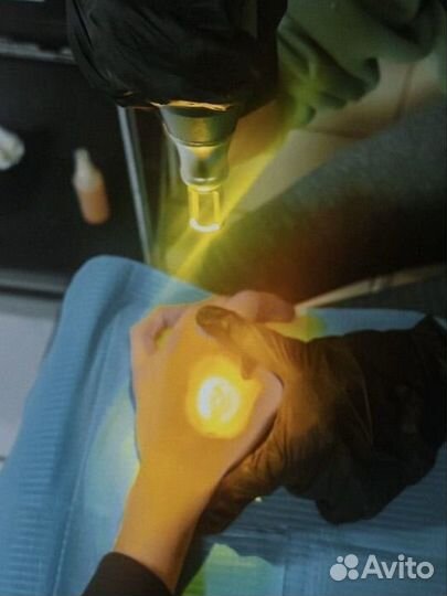 Лазерное удаление тату и татуажа