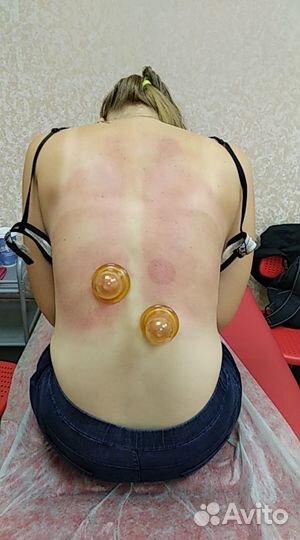 Нужны модели на массаж