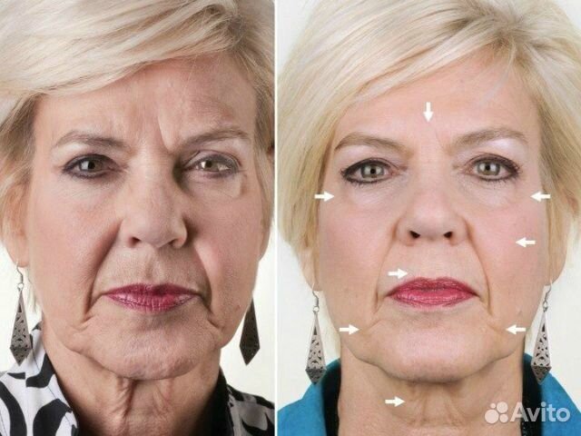 Гальванический спа-прибор против морщин