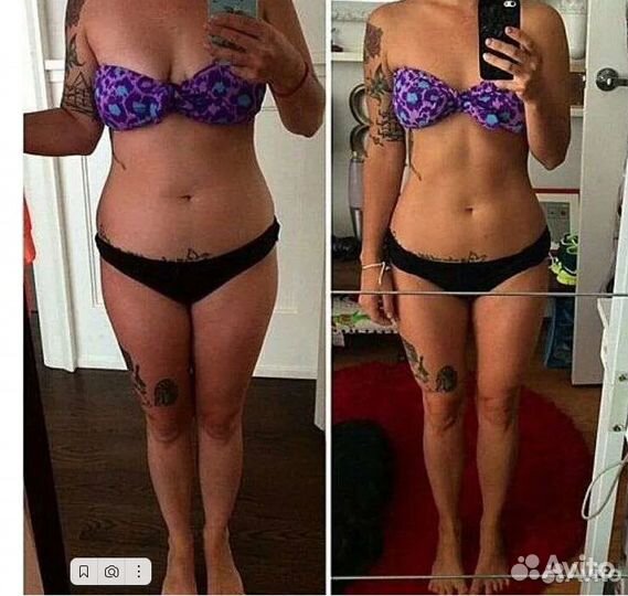 Плоский живот - размер за 1 процедуру в Перми