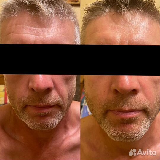 Массаж лица классический