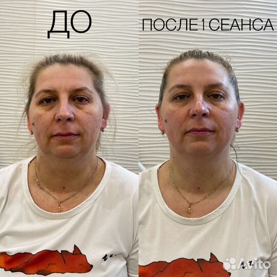 Массаж лица. Скульптурно-букальный,глубокотканный